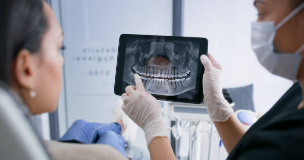 Licensed Tooth Extraction service in Rancho Mirage, CA - Smile Center Dentistry